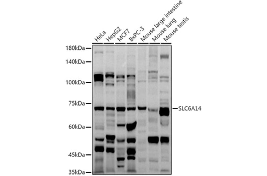 Western Blot - Anti-SLC6A14 Antibody (A8662) - Antibodies.com