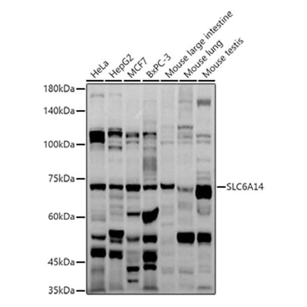 Western Blot - Anti-SLC6A14 Antibody (A8662) - Antibodies.com