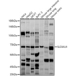 Western Blot - Anti-SLC6A14 Antibody (A8662) - Antibodies.com