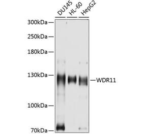 Western Blot - Anti-WDR11 Antibody (A8664) - Antibodies.com