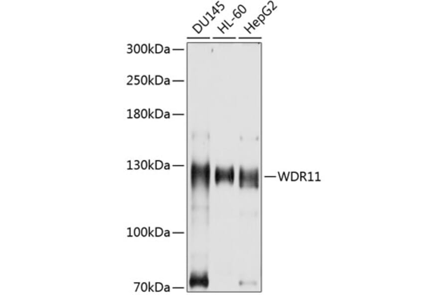 Western Blot - Anti-WDR11 Antibody (A8664) - Antibodies.com