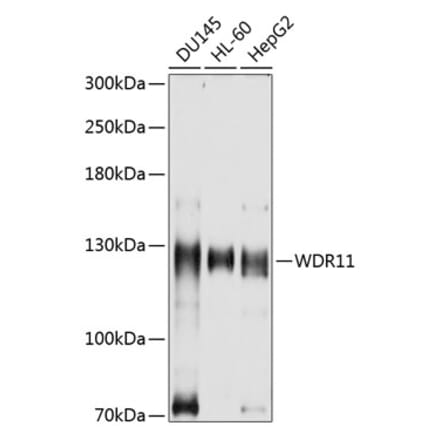 Western Blot - Anti-WDR11 Antibody (A8664) - Antibodies.com