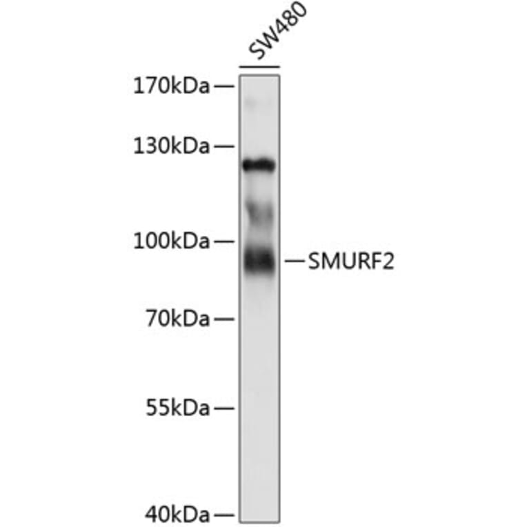 Western Blot - Anti-SMURF 2 Antibody (A8665) - Antibodies.com