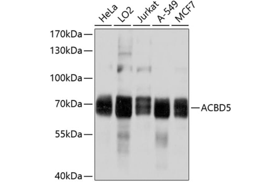 Western Blot - Anti-ACBD5 Antibody (A8666) - Antibodies.com