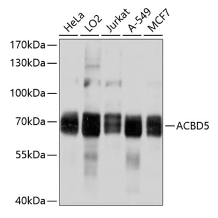 Western Blot - Anti-ACBD5 Antibody (A8666) - Antibodies.com