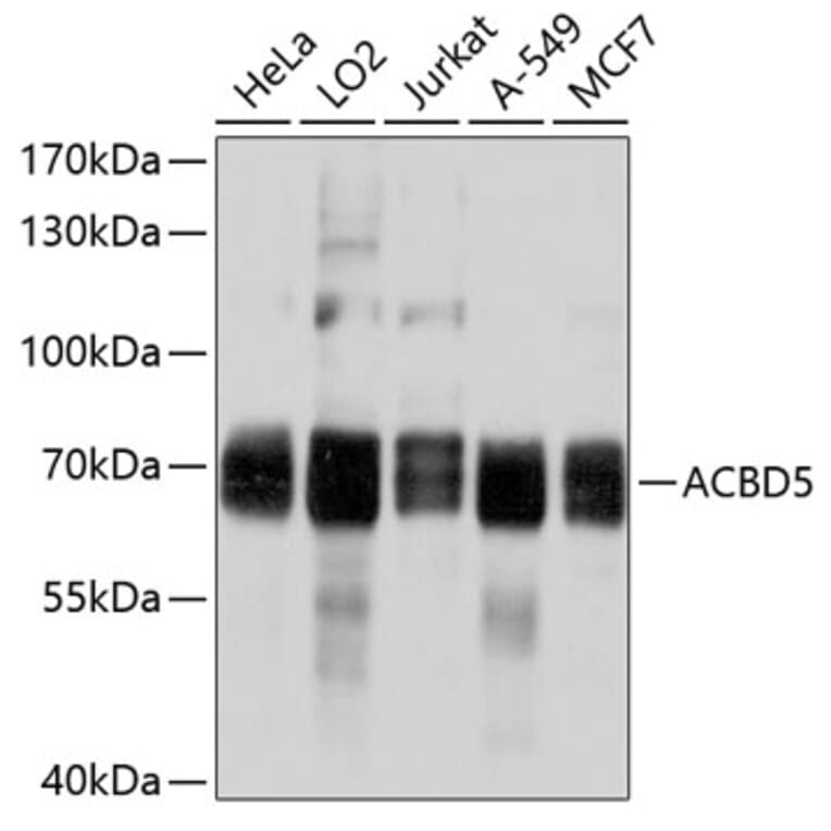 Western Blot - Anti-ACBD5 Antibody (A8666) - Antibodies.com