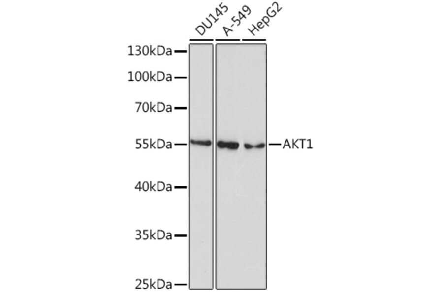 Western Blot - Anti-AKT1 Antibody [AMC0485] (A8669) - Antibodies.com