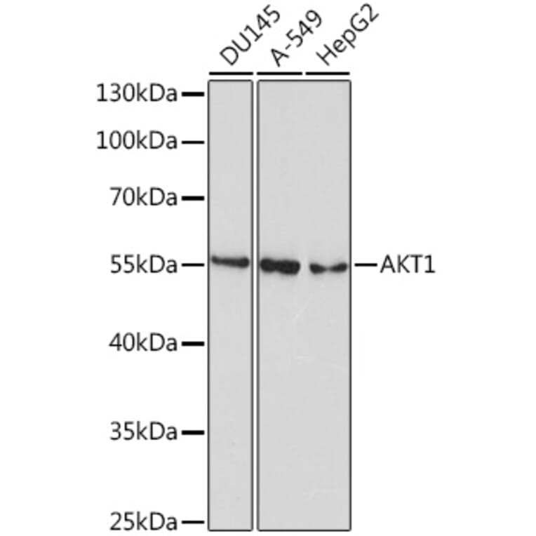 Western Blot - Anti-AKT1 Antibody [AMC0485] (A8669) - Antibodies.com