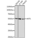 Western Blot - Anti-AKT1 Antibody [AMC0485] (A8669) - Antibodies.com