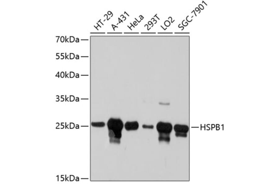 Western Blot - Anti-HSPB1 Antibody (A10606) - Antibodies.com