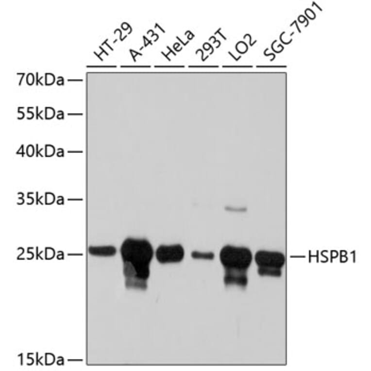 Western Blot - Anti-HSPB1 Antibody (A10606) - Antibodies.com