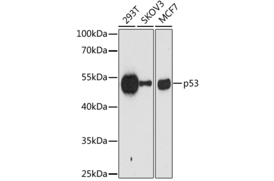 Western Blot - Anti-p53 Antibody [AMC0487] (A8672) - Antibodies.com