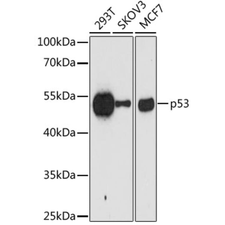 Western Blot - Anti-p53 Antibody [AMC0487] (A8672) - Antibodies.com