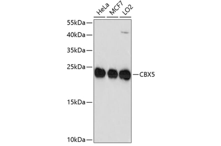 Western Blot - Anti-CBX5 Antibody (A10612) - Antibodies.com