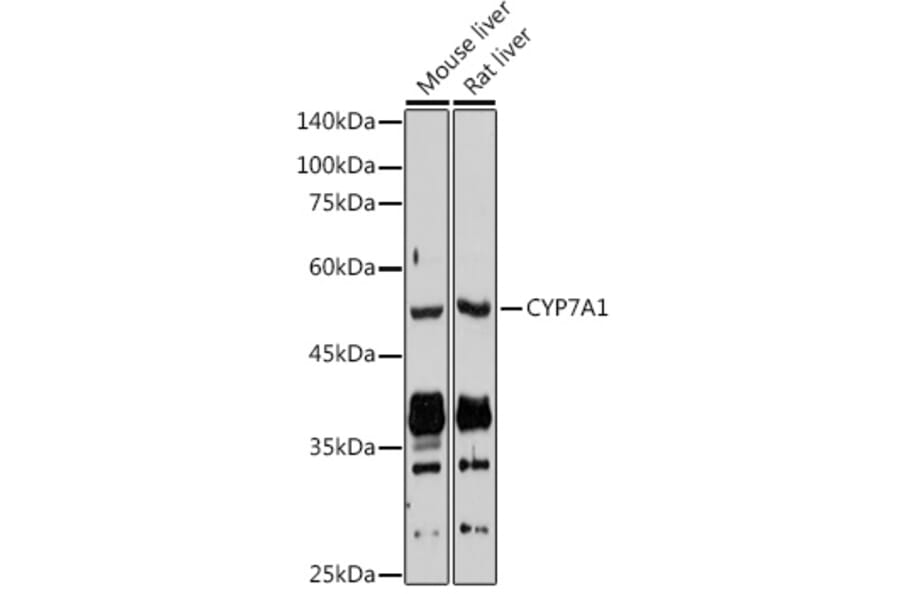 Western Blot - Anti-CYP7A1 Antibody (A8675) - Antibodies.com