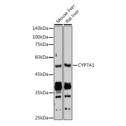 Western Blot - Anti-CYP7A1 Antibody (A8675) - Antibodies.com