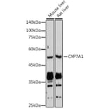 Western Blot - Anti-CYP7A1 Antibody (A8675) - Antibodies.com