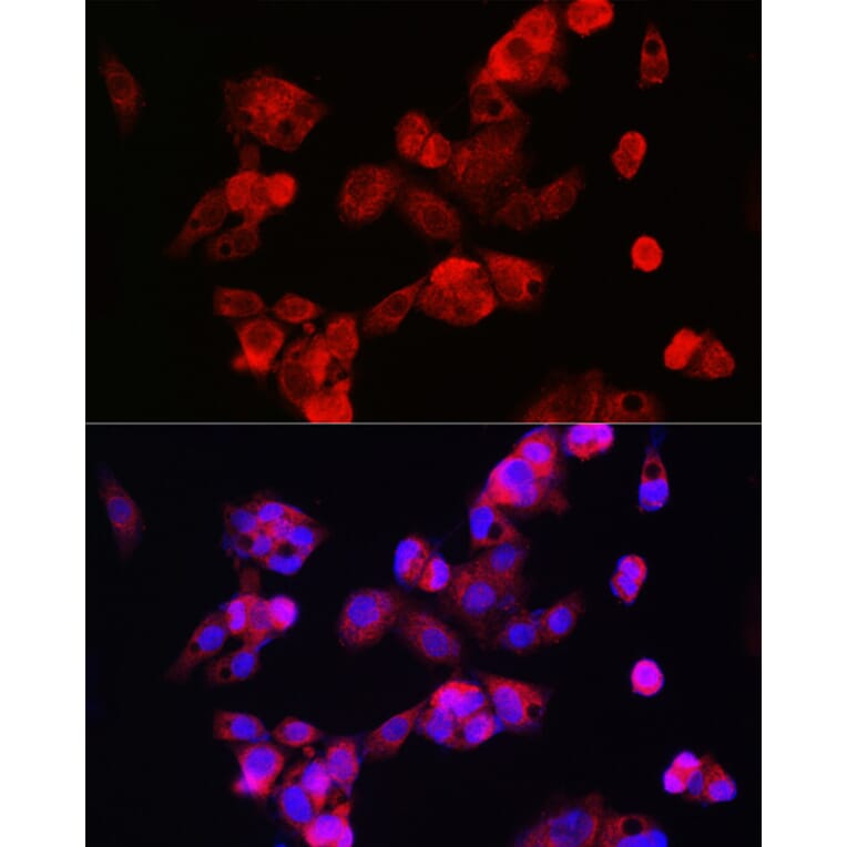 Immunofluorescence - Anti-CYP7A1 Antibody (A8675) - Antibodies.com