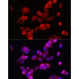 Immunofluorescence - Anti-CYP7A1 Antibody (A8675) - Antibodies.com