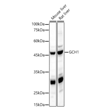 Western Blot - Anti-GCH1 Antibody (A8676) - Antibodies.com