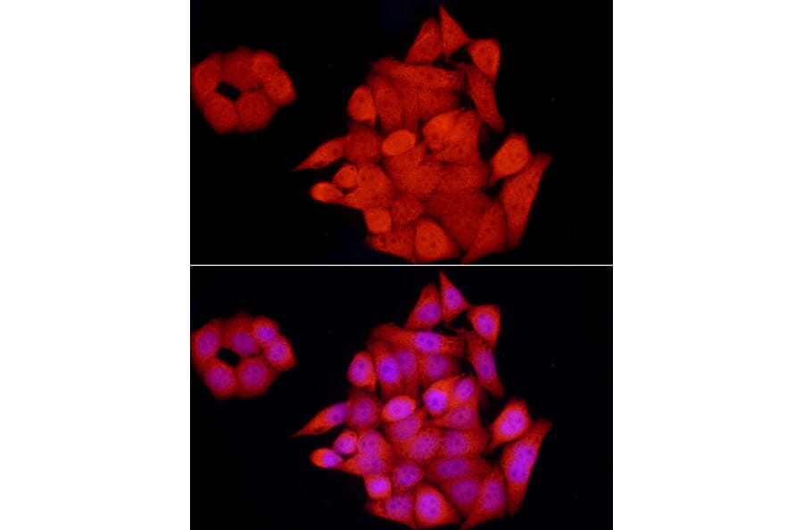 Immunofluorescence - Anti-GCH1 Antibody (A8676) - Antibodies.com