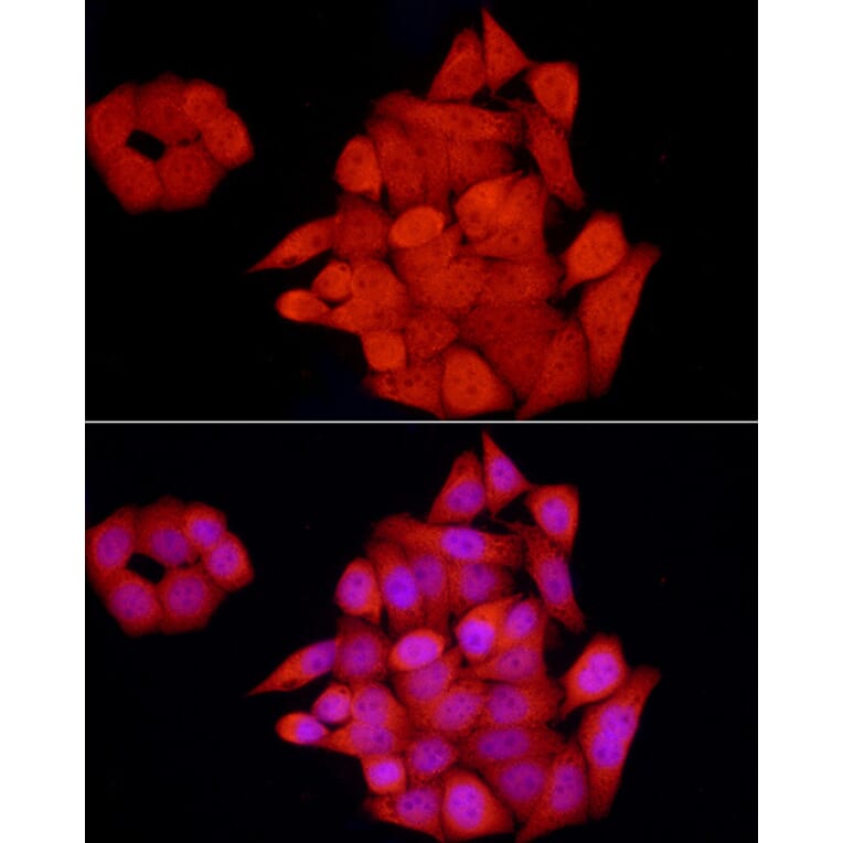 Immunofluorescence - Anti-GCH1 Antibody (A8676) - Antibodies.com
