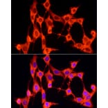 Immunofluorescence - Anti-GCH1 Antibody (A8676) - Antibodies.com