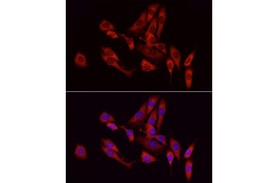 Immunofluorescence - Anti-GCH1 Antibody (A8676) - Antibodies.com