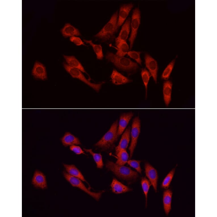 Immunofluorescence - Anti-GCH1 Antibody (A8676) - Antibodies.com
