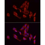 Immunofluorescence - Anti-GCH1 Antibody (A8676) - Antibodies.com
