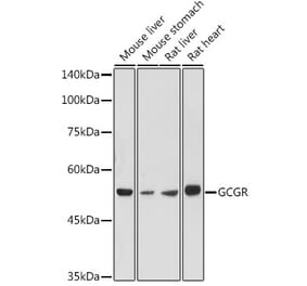 Western Blot - Anti-Glucagon Receptor Antibody (A8677) - Antibodies.com