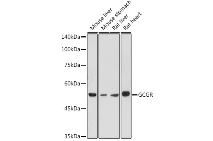 Western Blot - Anti-Glucagon Receptor Antibody (A8677) - Antibodies.com
