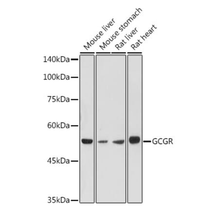 Western Blot - Anti-Glucagon Receptor Antibody (A8677) - Antibodies.com