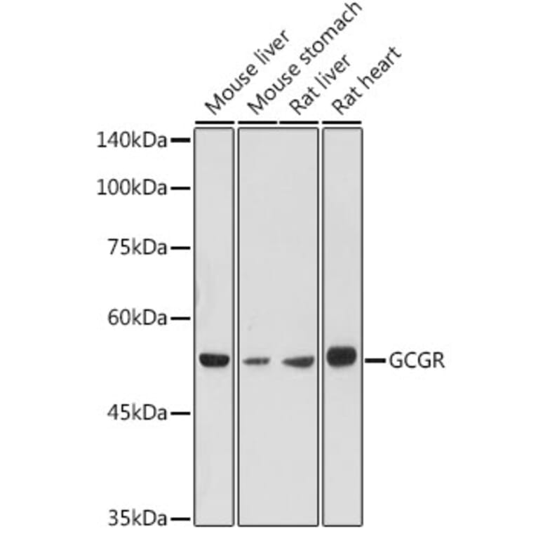 Western Blot - Anti-Glucagon Receptor Antibody (A8677) - Antibodies.com