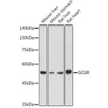 Western Blot - Anti-Glucagon Receptor Antibody (A8677) - Antibodies.com