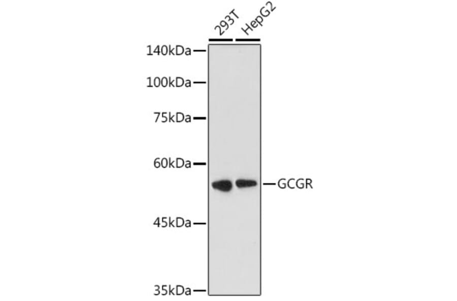 Western Blot - Anti-Glucagon Receptor Antibody (A8677) - Antibodies.com
