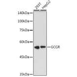 Western Blot - Anti-Glucagon Receptor Antibody (A8677) - Antibodies.com