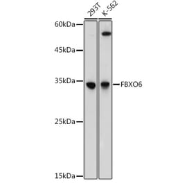 Western Blot - Anti-FbxO6 Antibody (A8694) - Antibodies.com
