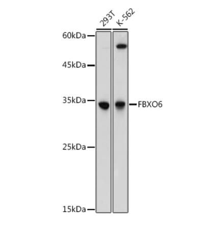 Western Blot - Anti-FbxO6 Antibody (A8694) - Antibodies.com