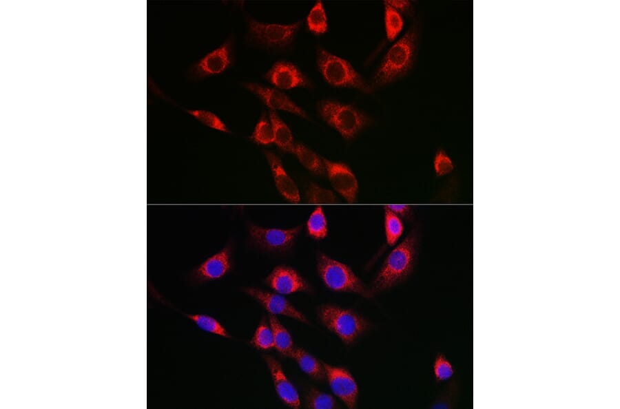 Immunofluorescence - Anti-FbxO6 Antibody (A8694) - Antibodies.com