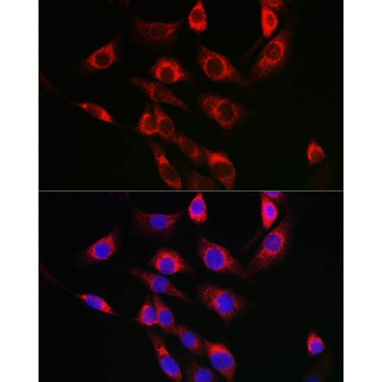 Immunofluorescence - Anti-FbxO6 Antibody (A8694) - Antibodies.com