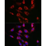 Immunofluorescence - Anti-FbxO6 Antibody (A8694) - Antibodies.com