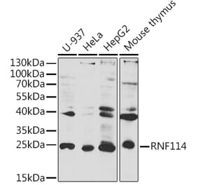 Western Blot - Anti-RNF114 Antibody (A8696) - Antibodies.com