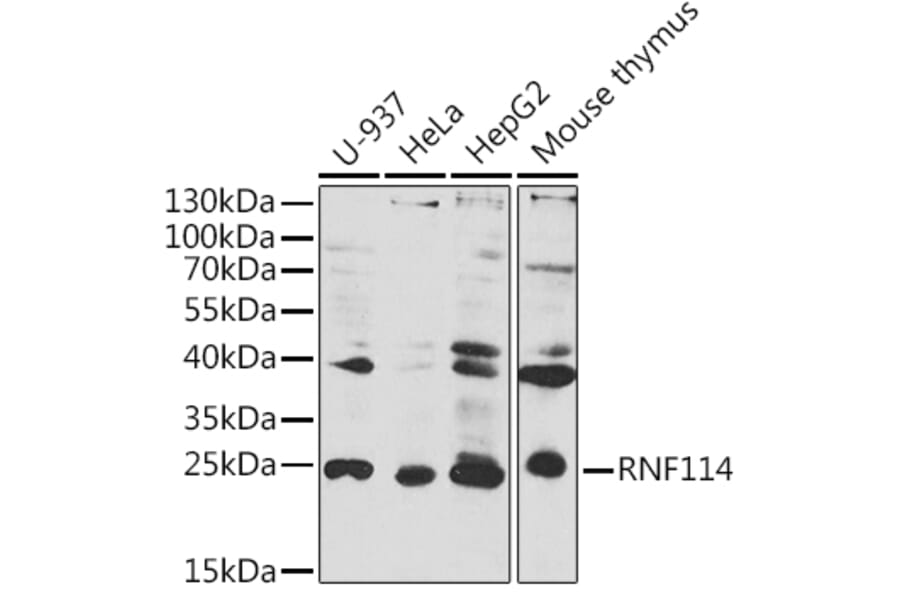 Western Blot - Anti-RNF114 Antibody (A8696) - Antibodies.com