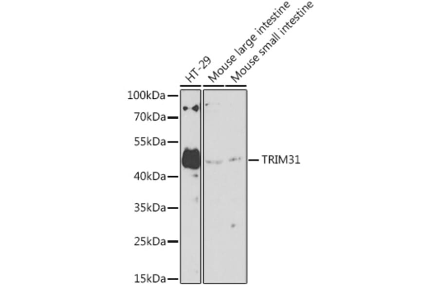 Western Blot - Anti-TRIM31 Antibody (A8699) - Antibodies.com