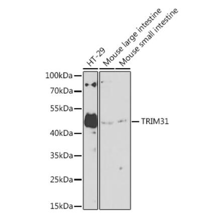 Western Blot - Anti-TRIM31 Antibody (A8699) - Antibodies.com