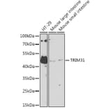 Western Blot - Anti-TRIM31 Antibody (A8699) - Antibodies.com