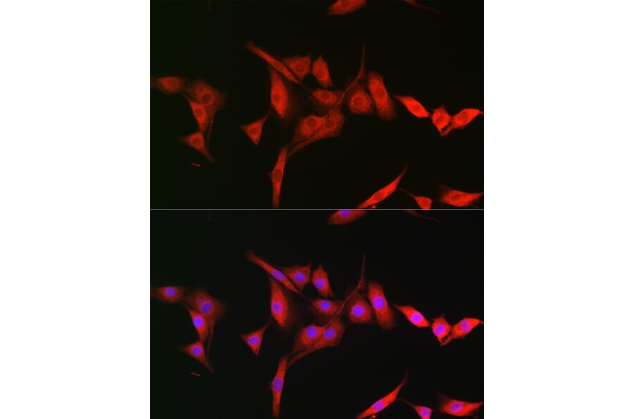 Immunofluorescence - Anti-TRIM31 Antibody (A8699) - Antibodies.com
