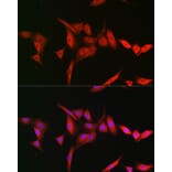 Immunofluorescence - Anti-TRIM31 Antibody (A8699) - Antibodies.com