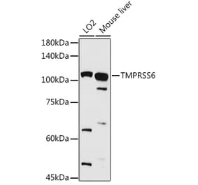 Western Blot - Anti-Matriptase 2 Antibody (A8702) - Antibodies.com